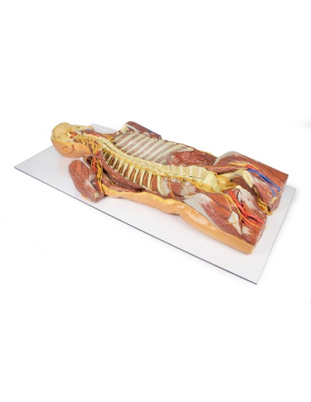 Dissezione profonda ventrale del corpo umano  (Vista posteriore) - Erler Zimmer 3D anatomy Series MP1410