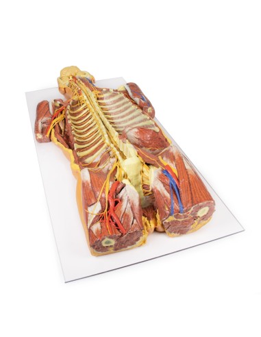 Dissezione profonda ventrale del corpo umano...