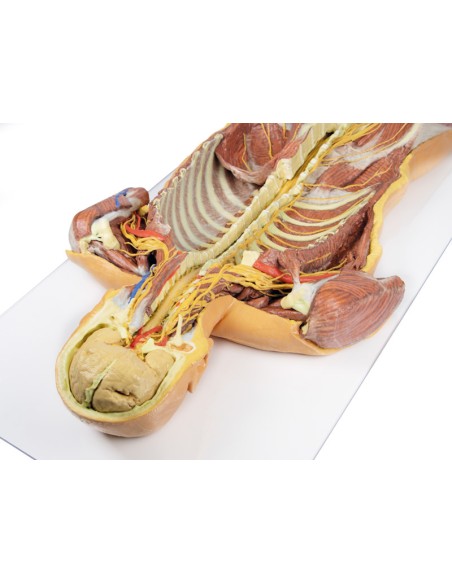 Disección ventral profunda del cuerpo humano (vista posterior) - Erler Zimmer 3D anatomy Series MP1410