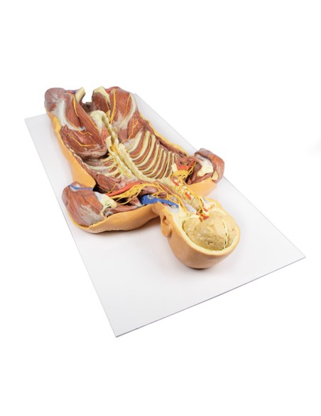 Disección ventral profunda del cuerpo humano (vista posterior) - Erler Zimmer 3D anatomy Series MP1410
