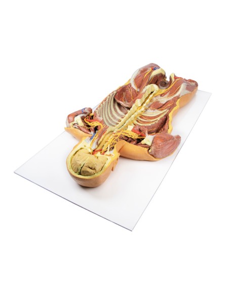 Tiefe ventrale Präparation des menschlichen Körpers (Rückansicht) - Erler Zimmer 3D-Anatomie Serie MP1410