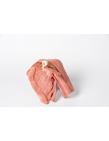 Dissection of the left shoulder - Superficial...