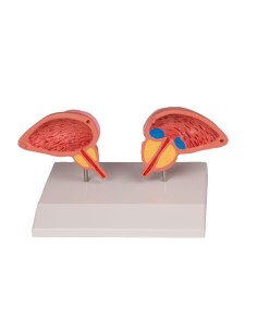 Erler Zimmer, anatomisches Modell der Prostata, in 2... 2