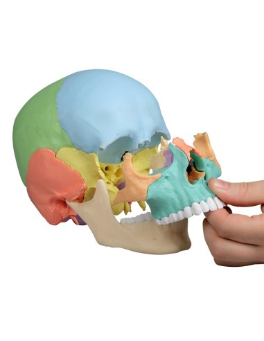Erler Zimmer skull decomposable into 22 parts...