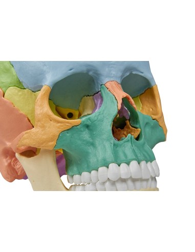 Erler Zimmer skull decomposable into 22 parts...