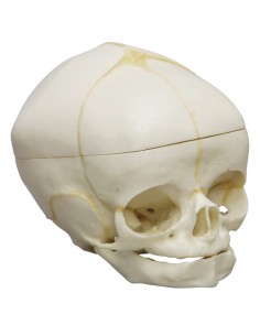 Cranio di feto di 40 settimane con calotta cranica... 2