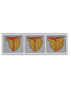 Anatomical model of male pelvis with 3D prostate in... 2