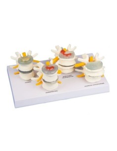 Erler Zimmer, anatomisches Modell der...