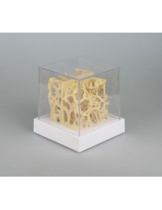 Erler Zimmer, confronto fra modelli di strutture ossee...