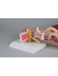 Erler Zimmer, anatomical model of vertebra with...