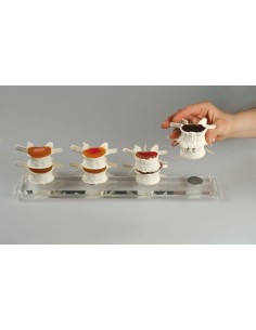 Erler Zimmer, Modèle anatomique des phases de... 2