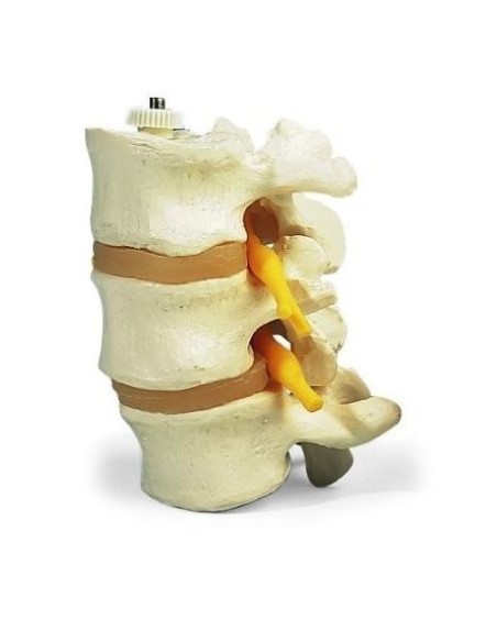 3 vertebre lombari, 3B Scientific, montaggio elastico A76/8