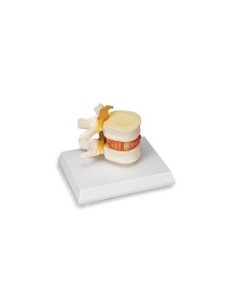 3B Scientific, simulateur de hernie discale modèle W22230