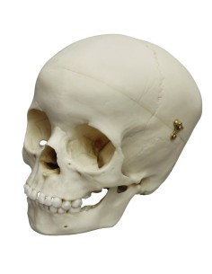 5-year-old child's skull Erler Zimmer 4730