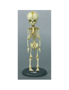 Erler Zimmer, teaching skeleton model of 30-week-old...