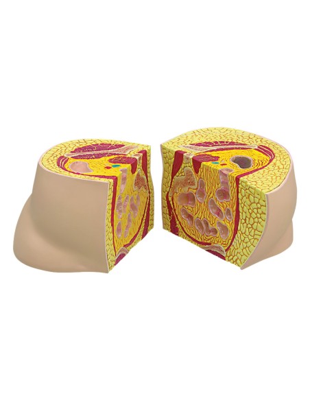 Modello di obesità 3B Scientific W33363