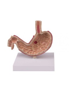Erler Zimmer, anatomical model of human stomach with K80...