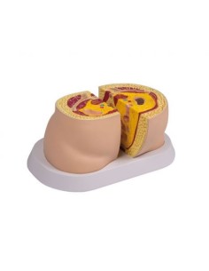 Erler Zimmer, anatomisches Modell der Adipositas-Typen M50