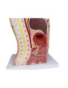 Erler Zimmer nasogastric tube and tracheotomy practice...