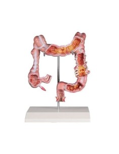 Erler Zimmer, Anatomical teaching model of colon with...
