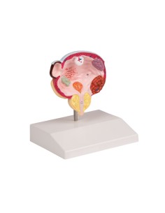 Maladies de la vessie et de la prostate Erler Zimmer K243