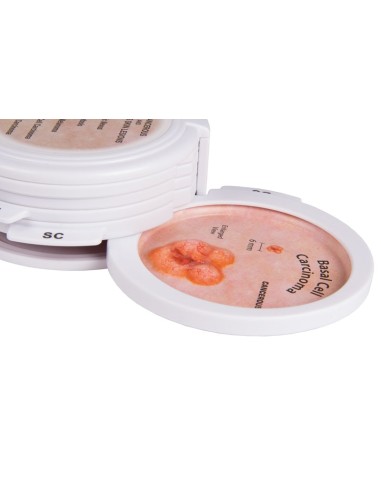 Lesioni cutanee, precancerose e cancerose Erler...