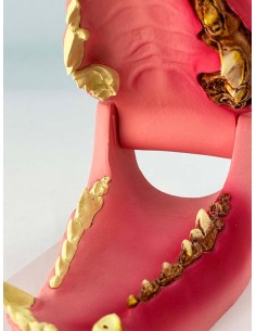 Mandíbula de perro, tamaño natural - sano/enfermo - Erler...