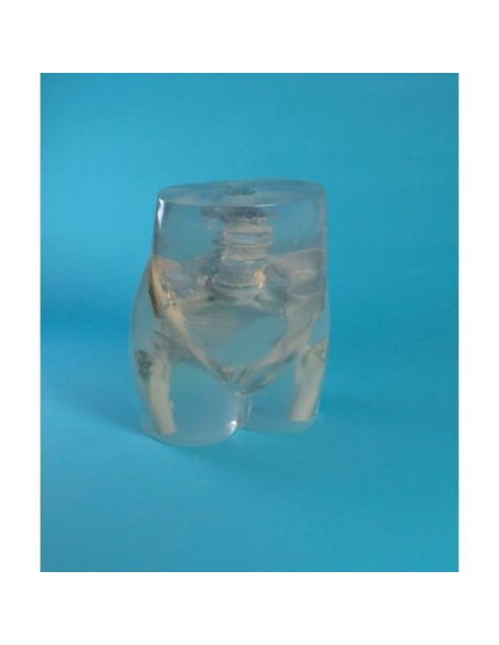 Simulateur de radiologie - bassin et hanche - transparent - Erler Zimmer 7240