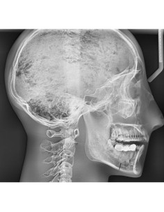 Simulateur de radiologie - Crâne avec vertèbres...