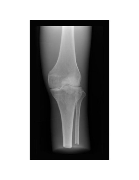 Radiologie-Simulator - Knie - undurchsichtig - Erler Zimmer 7255