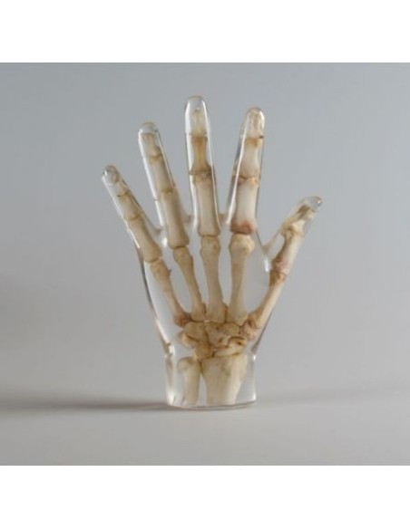 Simulador de Radiología - Mano - Transparente - Erler Zimmer 7210