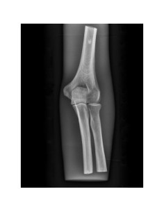 Radiology Simulator - Elbow - Transparent - Erler Zimmer...