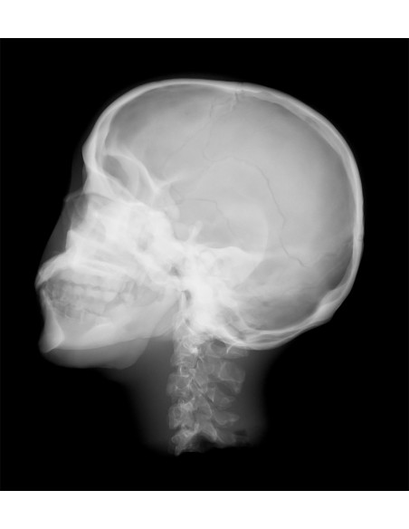 Simulador de radiología - Cráneo radiográfico con huesos artificiales - Opaco EZ-R16701