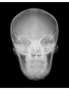 Radiology Simulator - Radiographic skull with artificial...