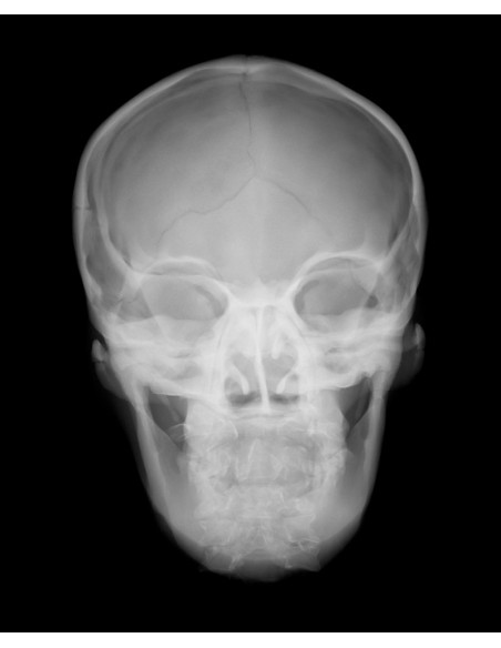 Radiologie-Simulator - Röntgenschädel mit künstlichen Knochen - Transparent EZ-R16700