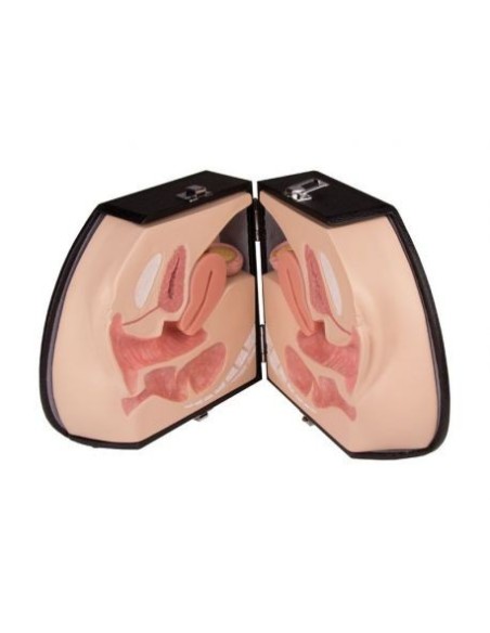 Simulatore per Ginecologia - Organi genitali femminil - Erler Zimmer LM30