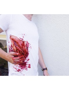 Moulage and simulation of large laceration with bleeding...