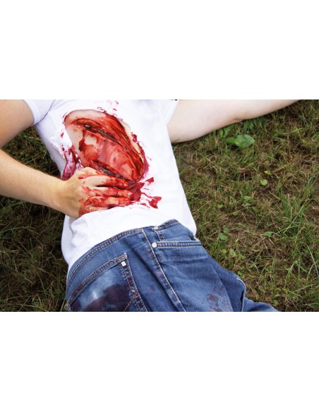 Moulage und Simulation einer großen Schnittwunde mit Blutungsfunktion Erler Zimmer NW100