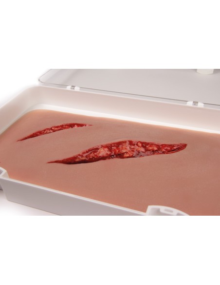 Moulage and simulation of large laceration with bleeding function Erler Zimmer NW100