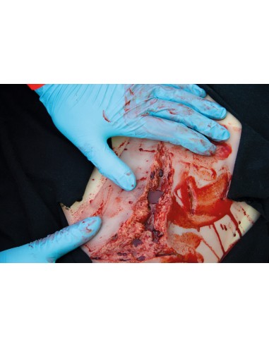 Moulage e simulazione di ampia lacerazione con...