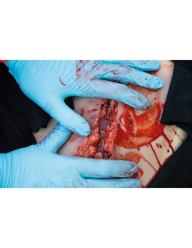Moulage et simulation d'une grande lacération...