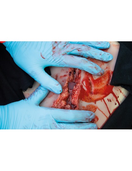 Moulage e simulazione di ampia lacerazione con lacerazioni minori con funzione di sanguinamento Erler Zimmer NW101