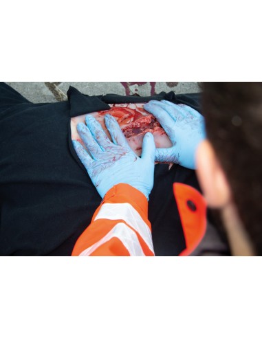 Moulage und Simulation einer großen Platzwunde...