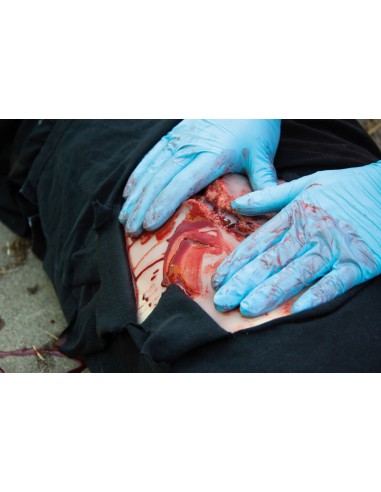 Moulage e simulazione di ampia lacerazione con...
