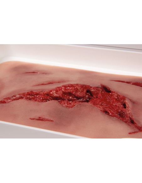 Moulage e simulazione di ampia lacerazione con lacerazioni minori con funzione di sanguinamento Erler Zimmer NW101