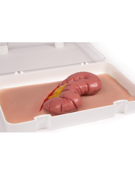 Moulage und Simulation einer abdominalen Wunde mit Darmvorwölbung Erler Zimmer NW109