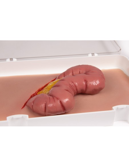 Moulage et simulation d'une plaie abdominale avec protrusion intestinale Erler Zimmer NW109