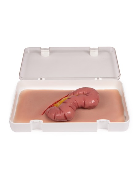 Moulage y simulación de herida abdominal con protrusión intestinal Erler Zimmer NW109