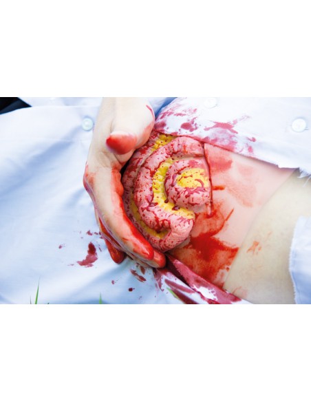 Moulage und Simulation einer abdominalen Wunde mit Dünndarmvorwölbung Erler Zimmer NW111