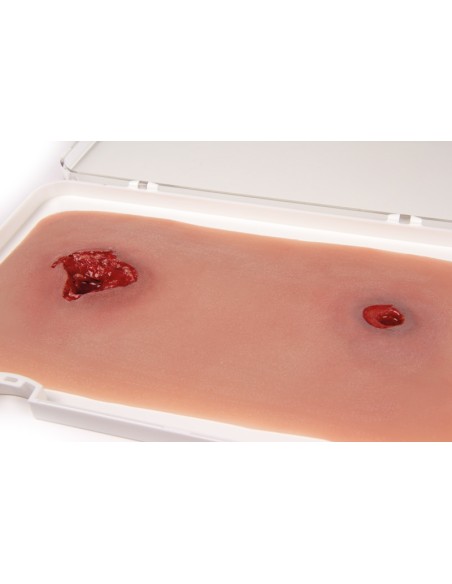 Moulage et simulation d'une blessure par balle à la jambe avec fonction de saignement Erler Zimmer NW105